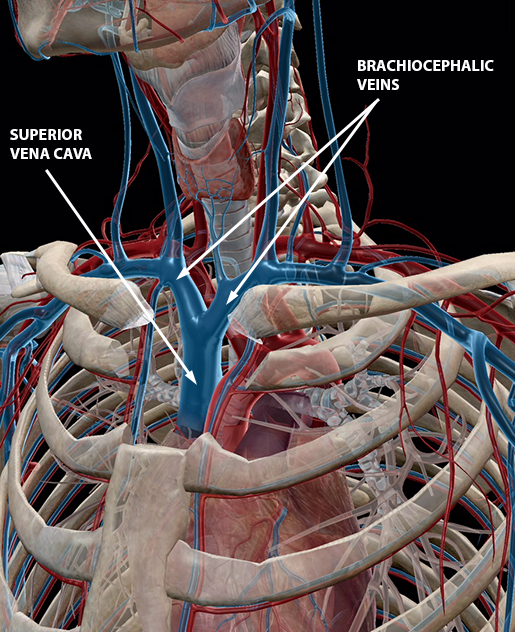 What's Blood Got To Do With It? Blood Vessel Basics